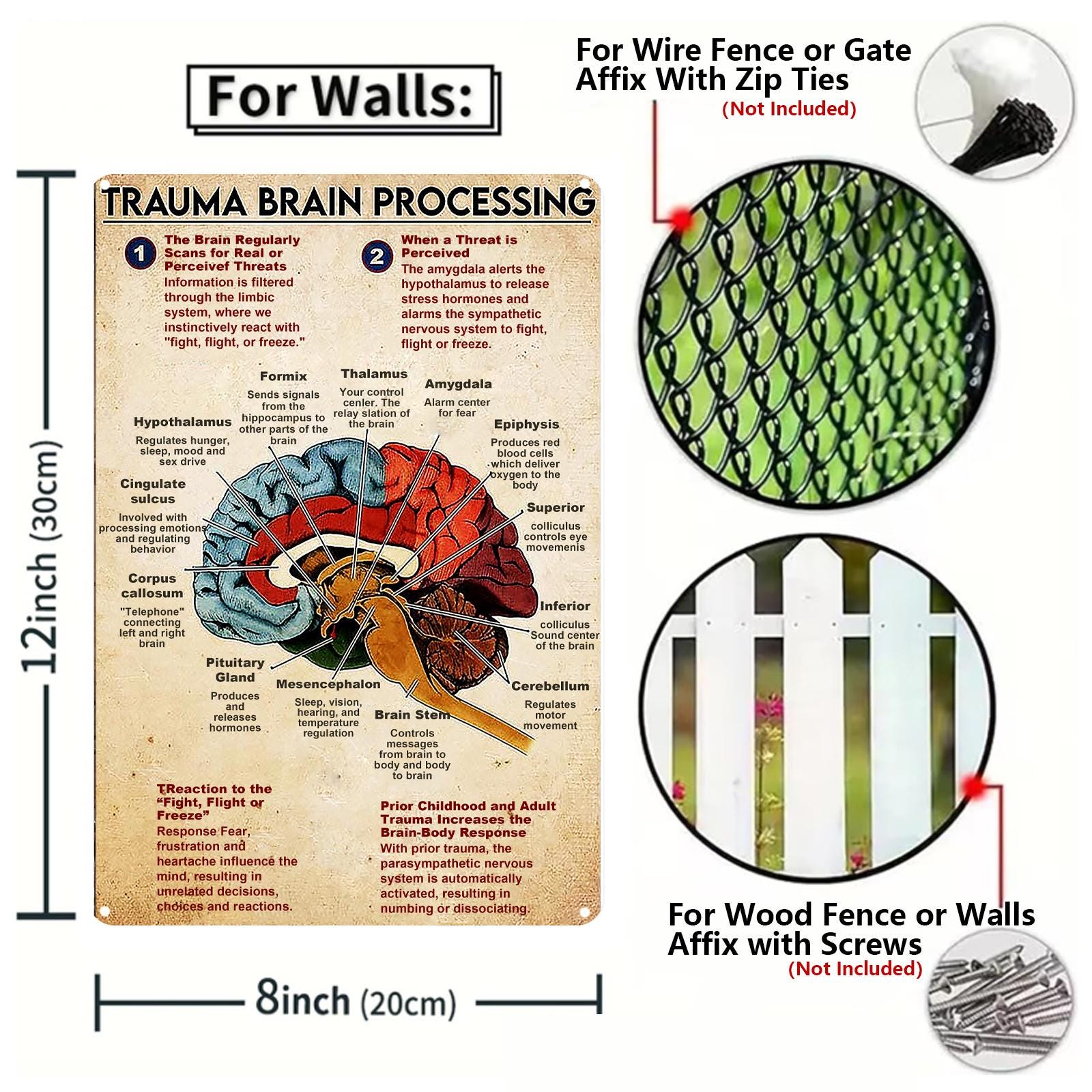 Trauma Brain Processing Anatomy Metal Sign: Vintage Clinic Office Decor