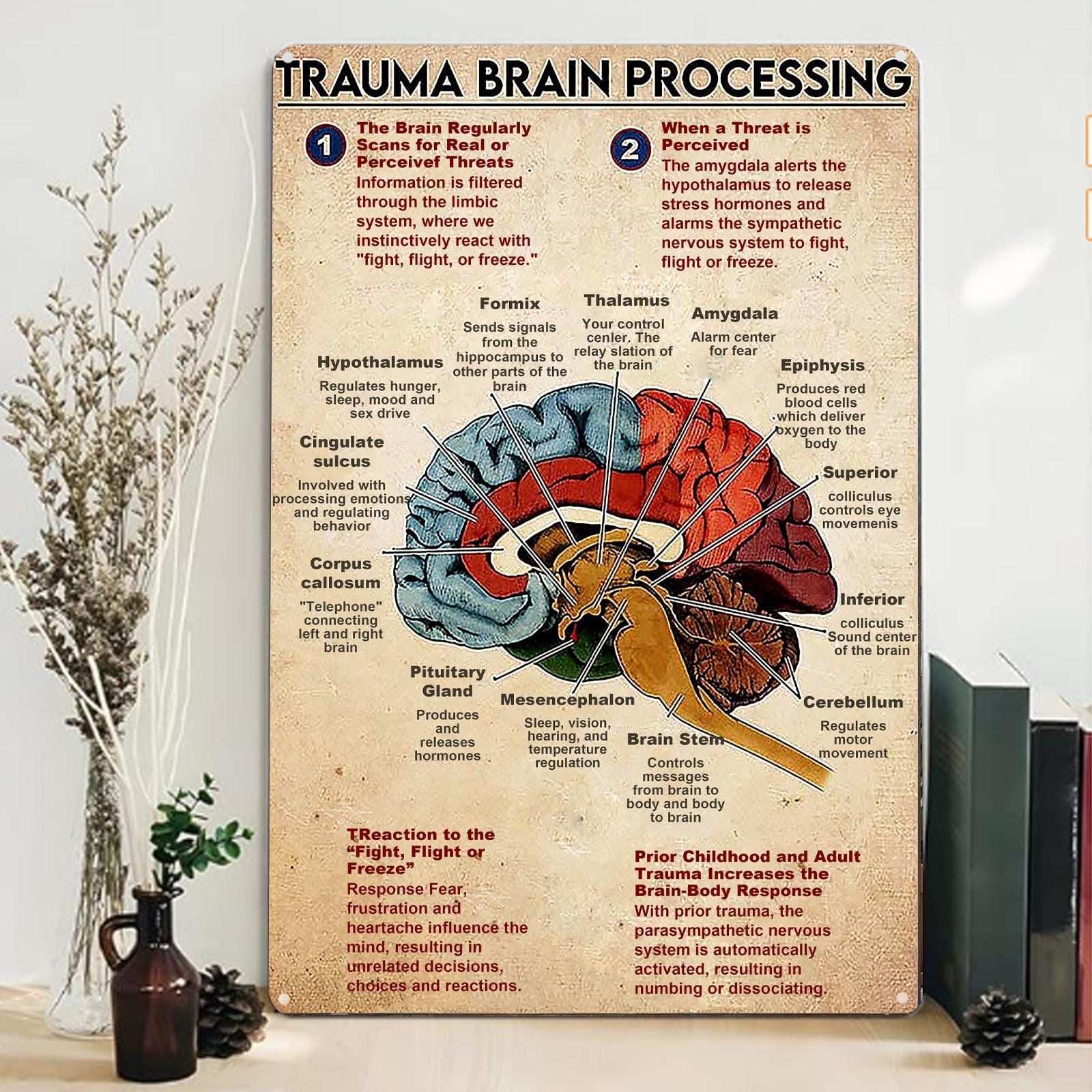 Trauma Brain Processing Anatomy Metal Sign: Vintage Clinic Office Decor