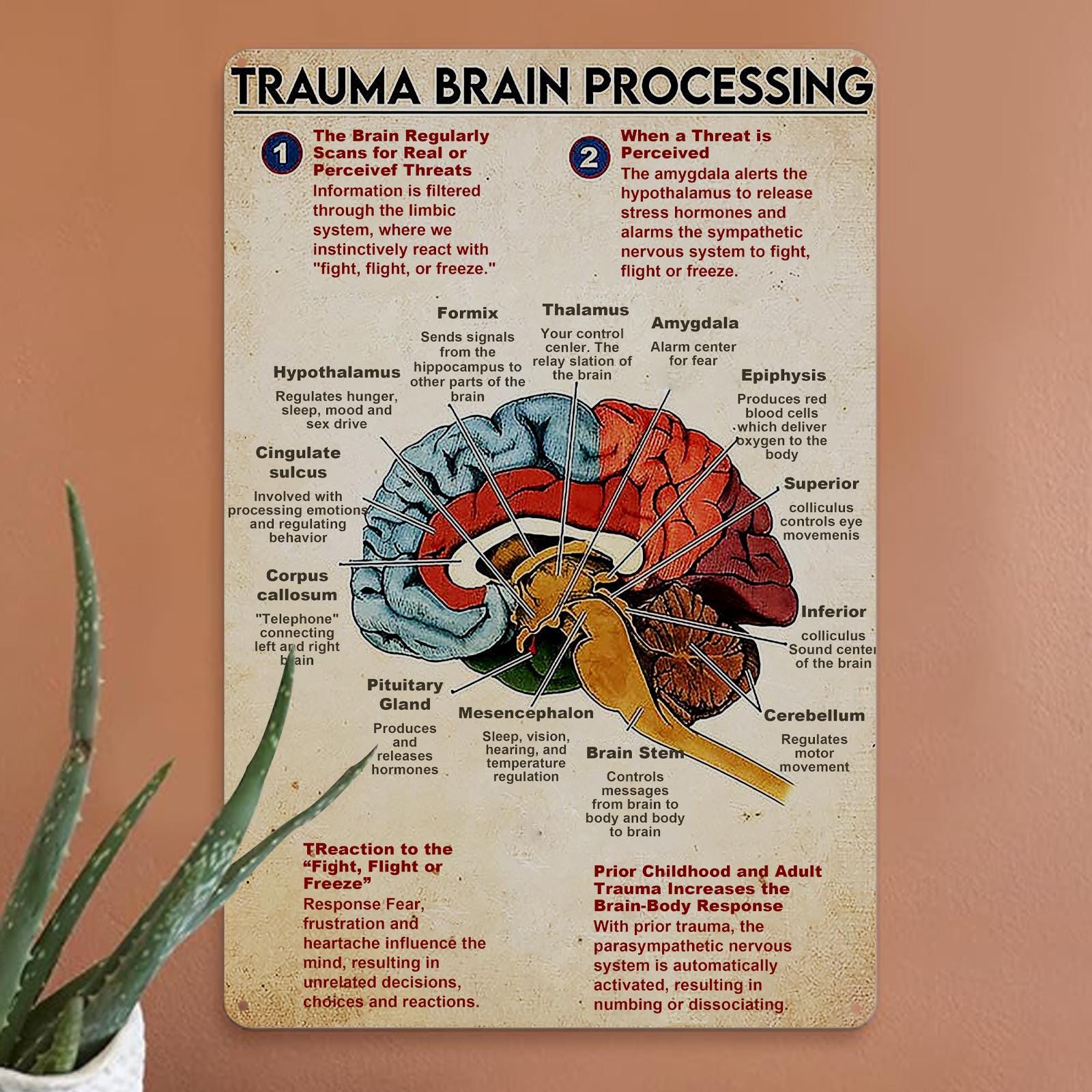 Trauma Brain Processing Anatomy Metal Sign: Vintage Clinic Office Decor